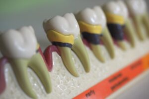 菊名の歯科、歯医者ならココセトデンタルクリニックで30代からのデンタルケアについての解説