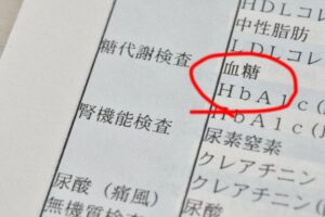 菊名の歯医者、ココセトデンタルクリニックでコーヒーが歯周病予防になる？コーヒーと歯周病の関係性を解説