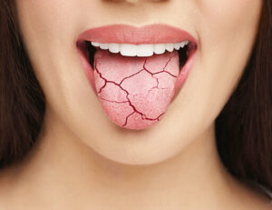 菊名の歯医者、ココセトデンタルクリニックでコーヒーが歯周病予防になる？コーヒーと歯周病の関係性を解説